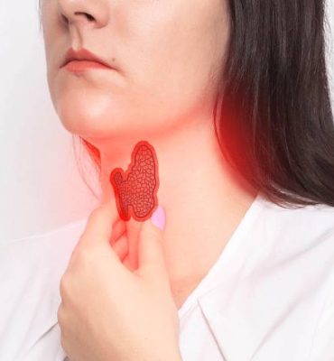 Thyroid Management