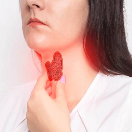Thyroid Management