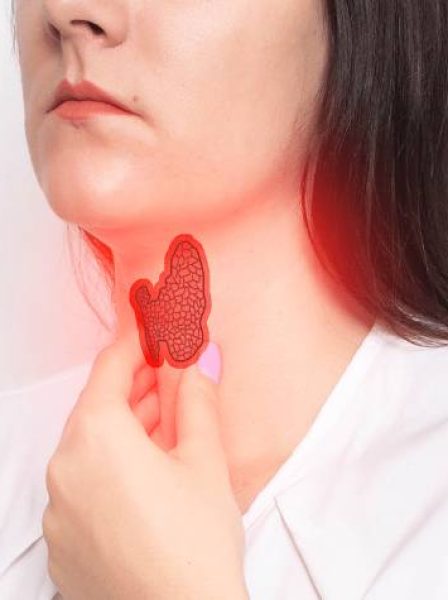 Thyroid Management
